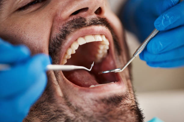 Best Tooth Pain Emergency Relief  in Glenmora, LA