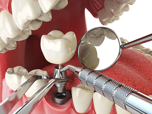 Best Emergency Tooth Extraction  in Glenmora, LA